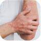 Psoriasis Moisturising Creams