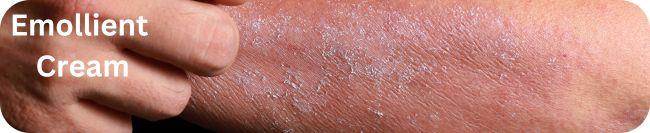 image Emollient Creams