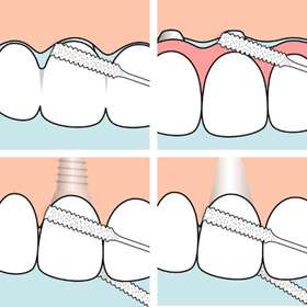 TePe Bridge & Implant Floss 30pcs