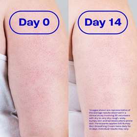 E45 Bumpy Skin Smoothing Cream 100g