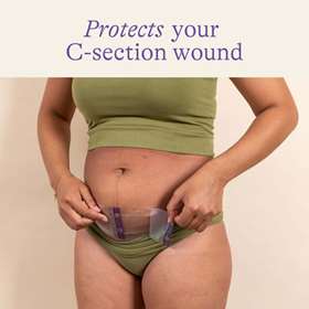 Lansinoh C-Section Hydrogel Pads 2